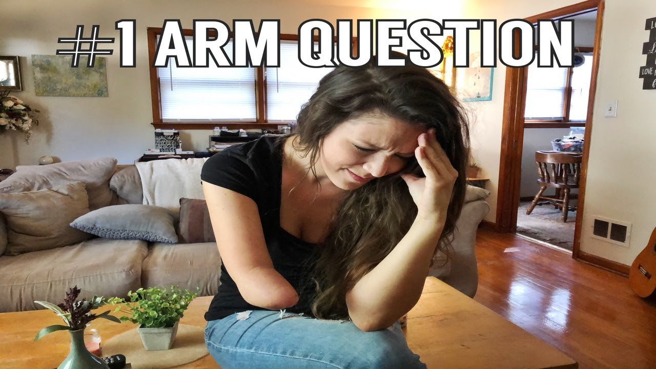 People Ask Me This EVERY DAY  | Amputee Story