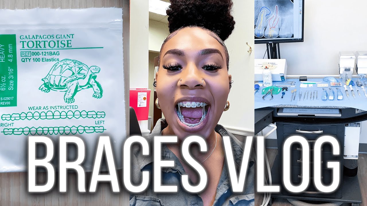 Braces Vlog! I Got Elastics + Do This If You Have Braces Because They TRIED ME! | KDiani