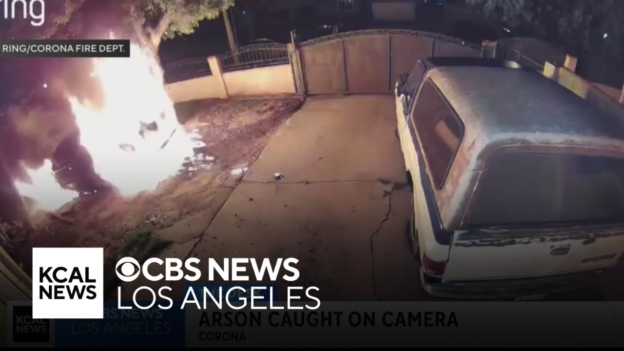Arsonist catches fire while setting car ablaze in Corona