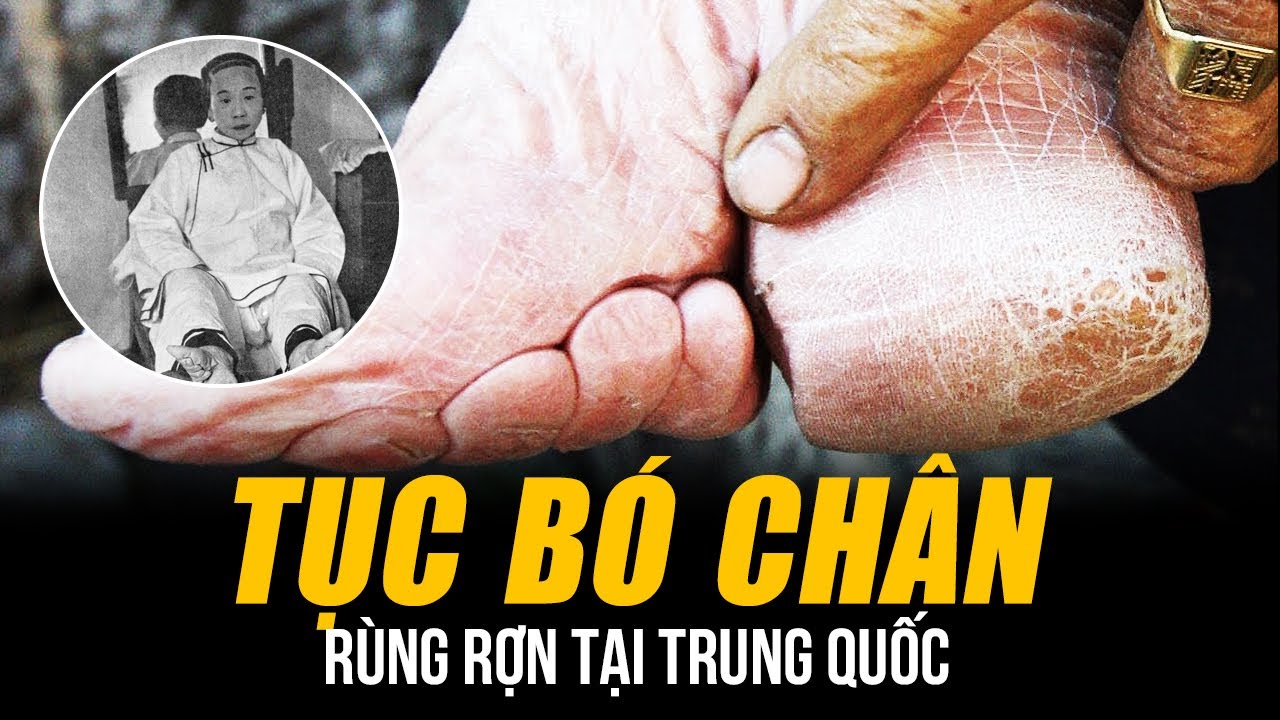TỤC BÓ CHÂN CỦA NGƯỜI TRUNG QUỐC & CÂU CHUYỆN RÙNG RỢN CÓ THỂ BẠN CHƯA BIẾT!
