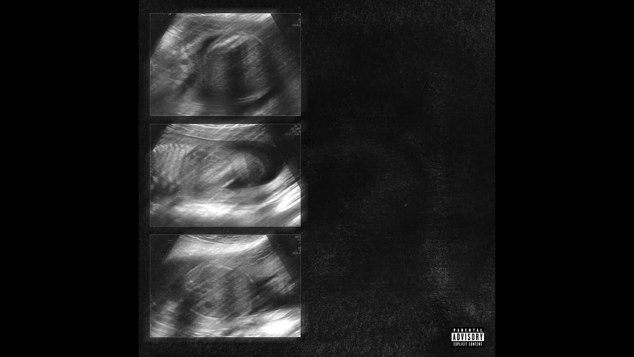 ULTRASOUND (DISS 21+)