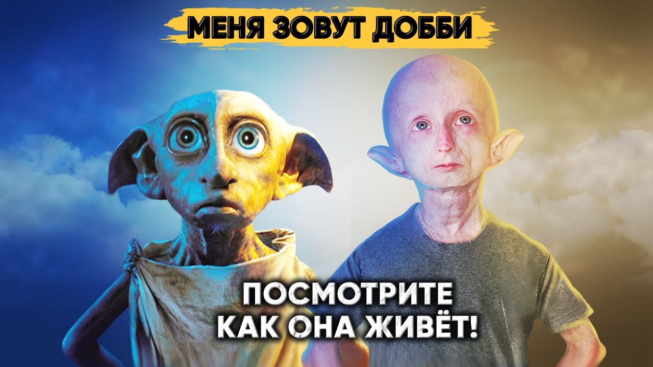ДОББИ В РЕАЛЬНОЙ ЖИЗНИ. Удивительная история девочки из Сибири.