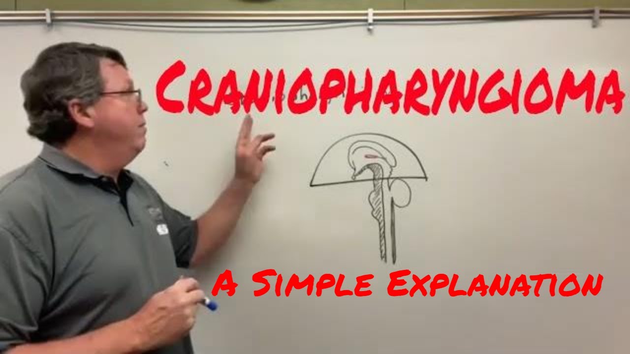 Craniopharyngioma A Simple Explanation
