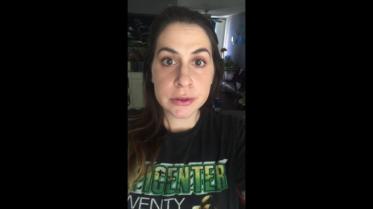 2 weeks post-op for Jaw surgery - Lefort 1 Osteotomy