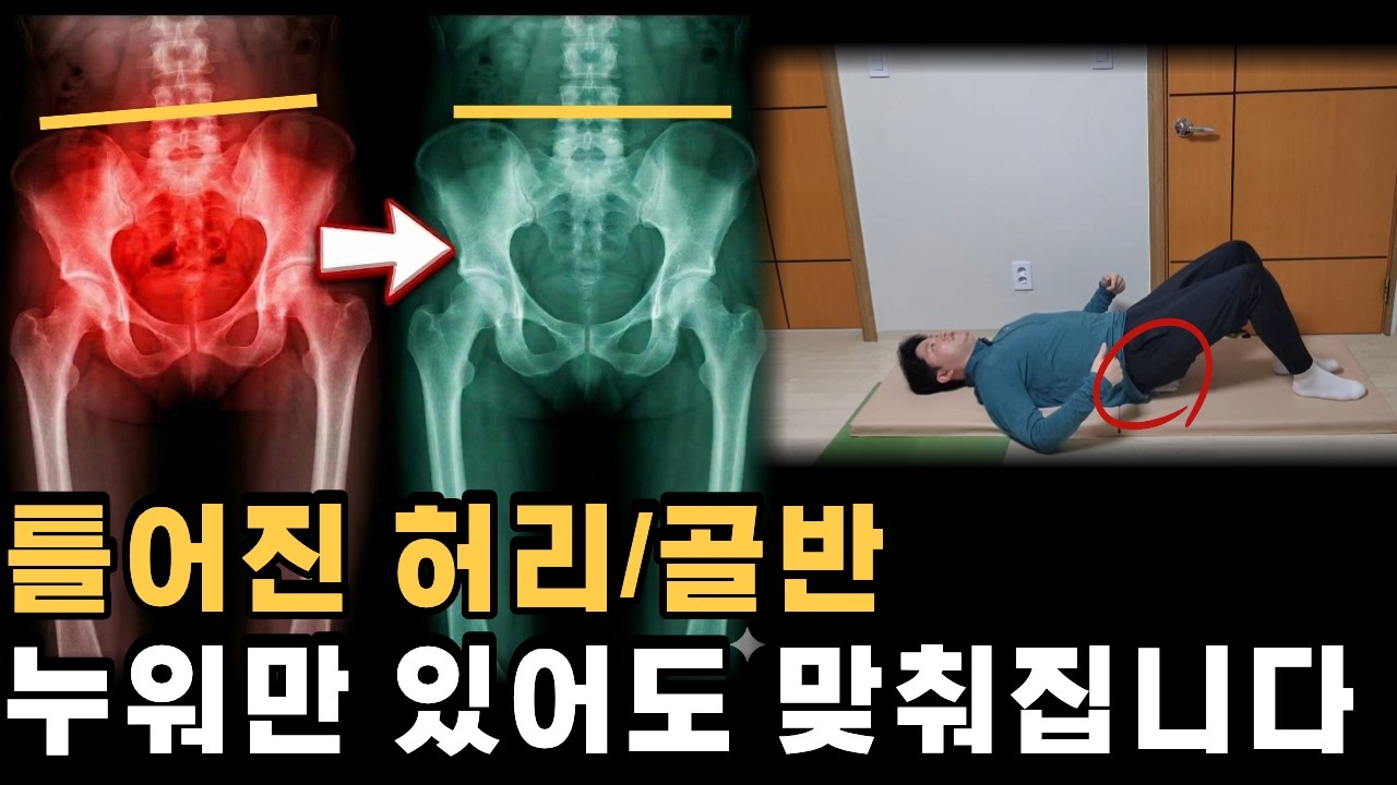 10년 묵은 허리 통증, '이것' 깔고 누워서 수술 피했습니다.