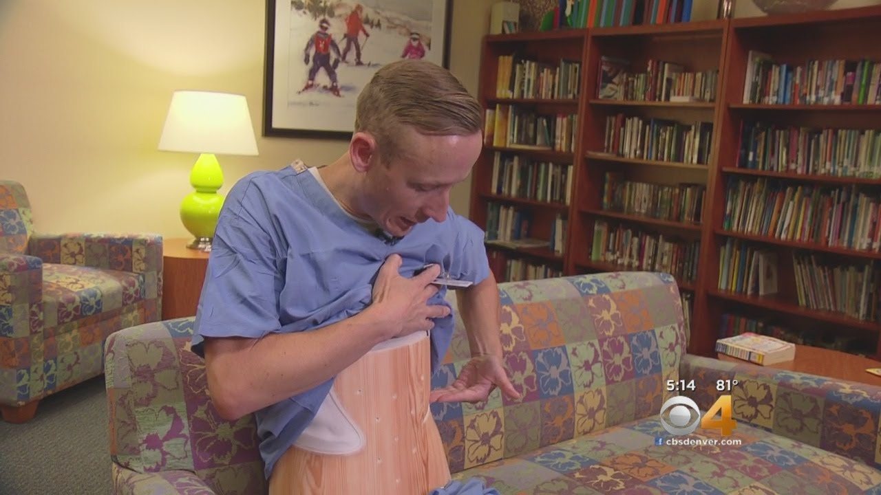 Doctor Wears Back Brace To Experience Scoliosis Treatment