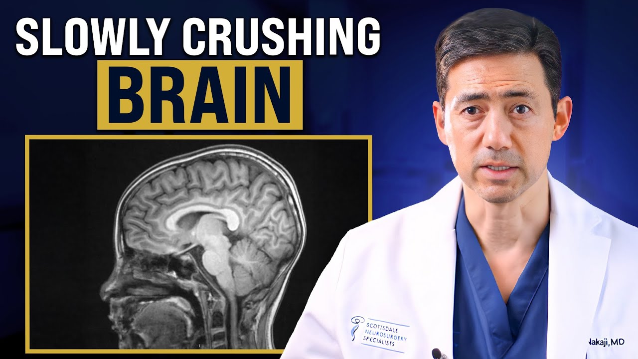 Why Brain Tumors Can Hide for Years