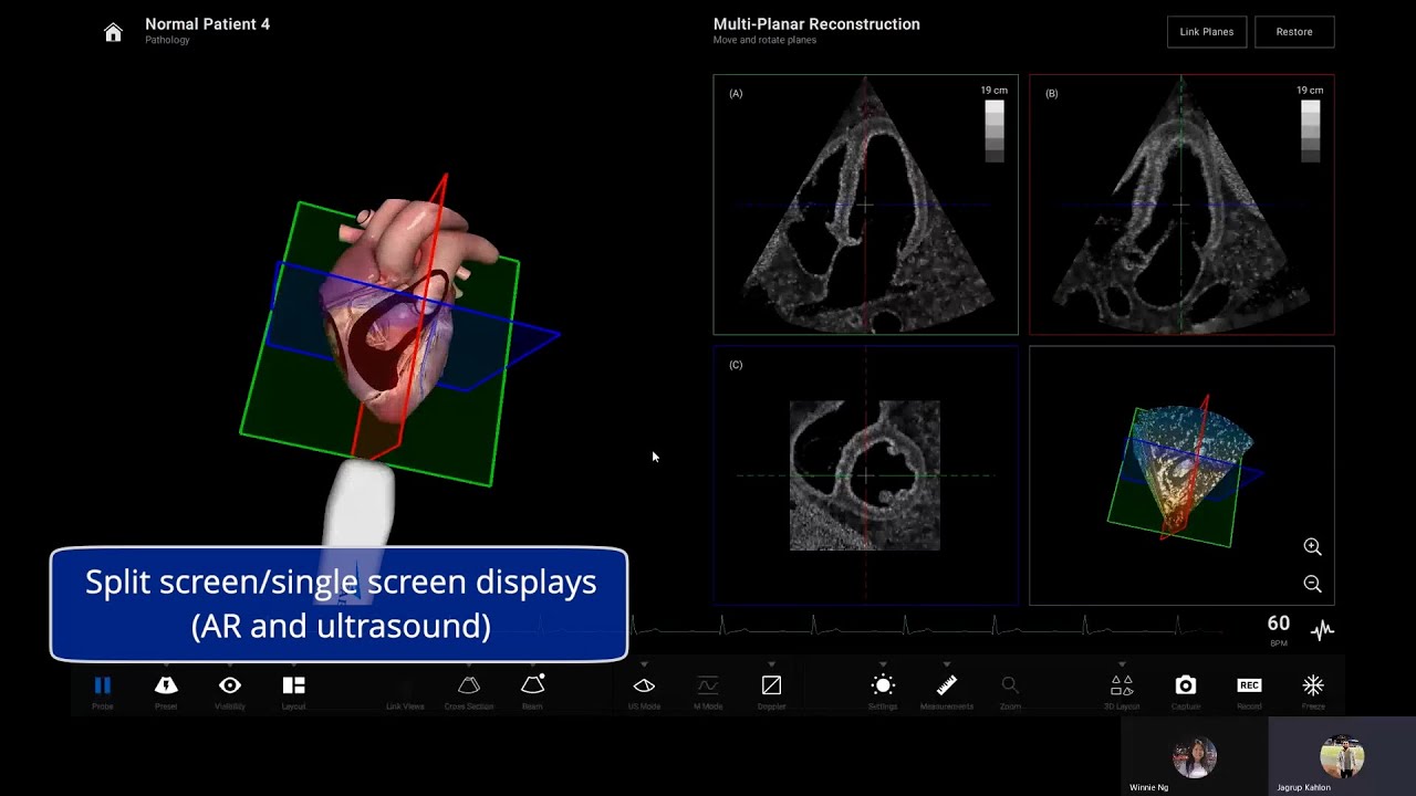 CAE Vimedix 3.2 | Explore High-fidelity Simulation In Ultrasound Education and Training