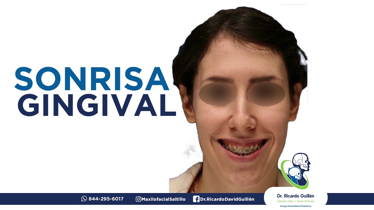 Tipos de Deformidades Dentofaciales