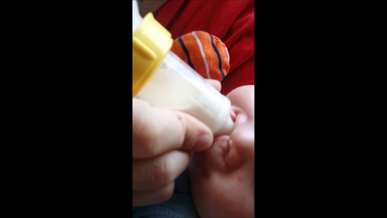 Haberman  bottle Clift lip