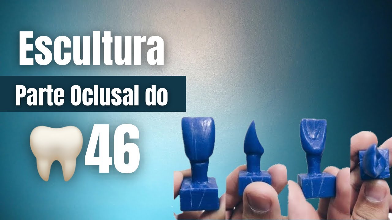 Escultura da parte oclusal do dente 46