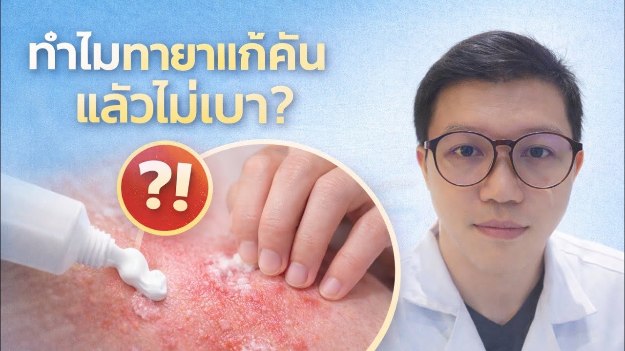 ทำไมทายา แก้คันแล้ว ไม่เบา ตอบคำถามใต้คลิป 21มค.69