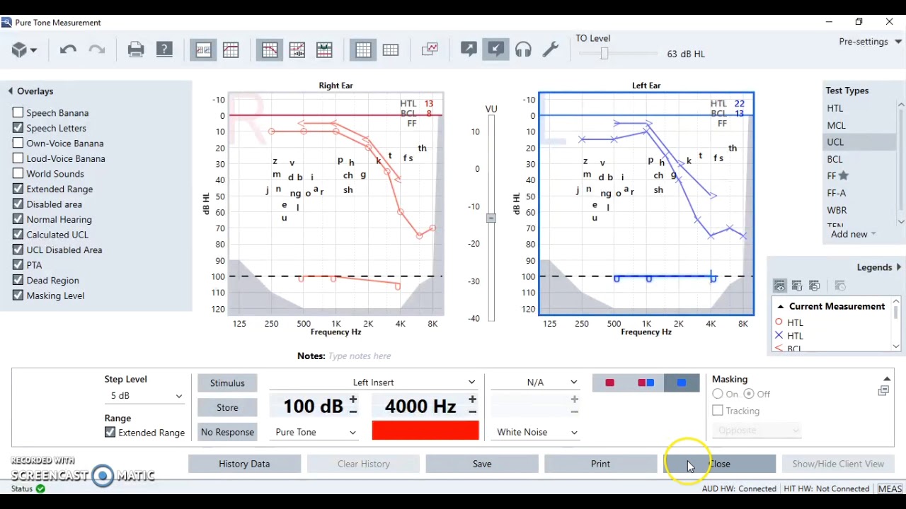 Understanding a Hearing Test