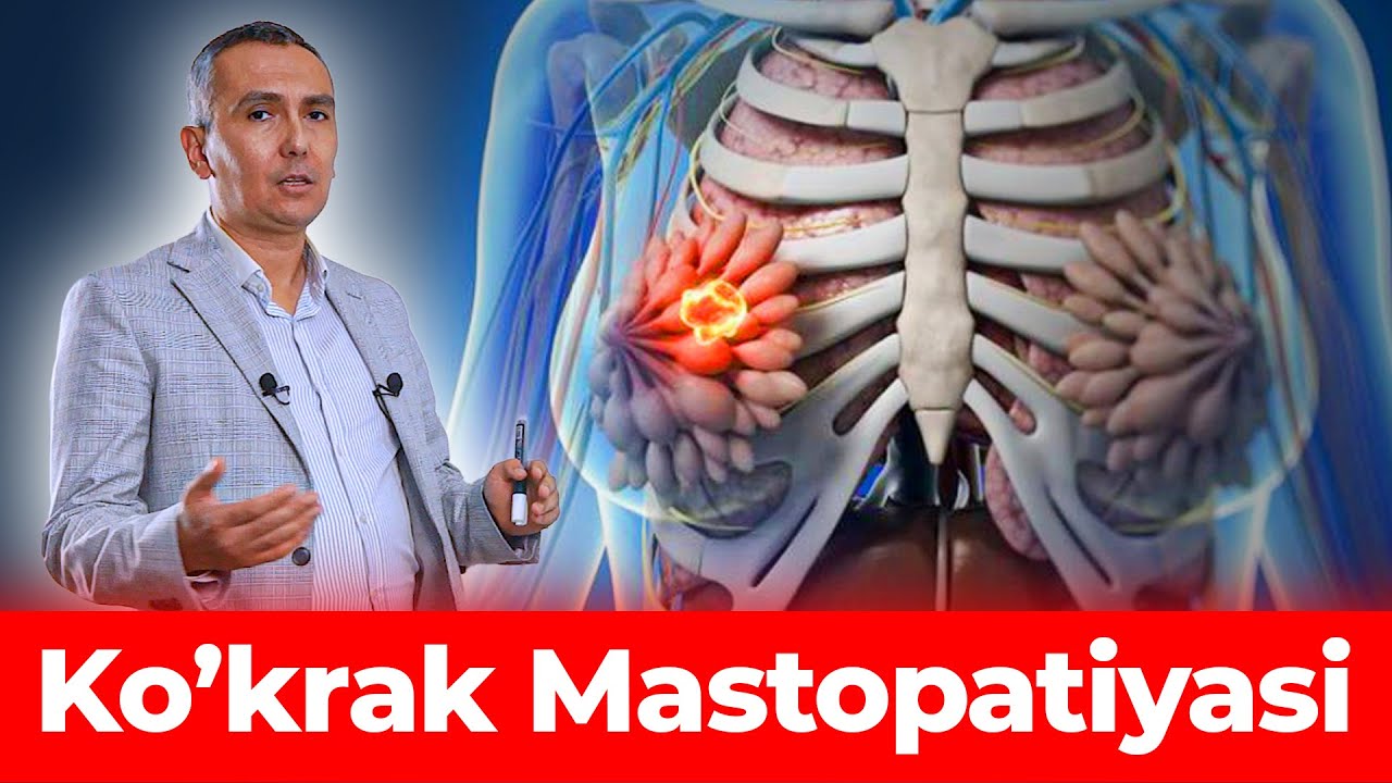 Ko'krak (sut bezi) Mastopatiyasi belgilari va qachon shifokorga borish haqida!