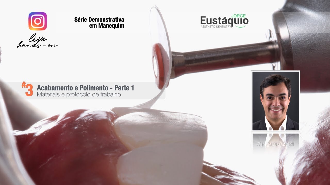 Live  Hands-on - Acabamento e polimento em anteriores - Parte 1