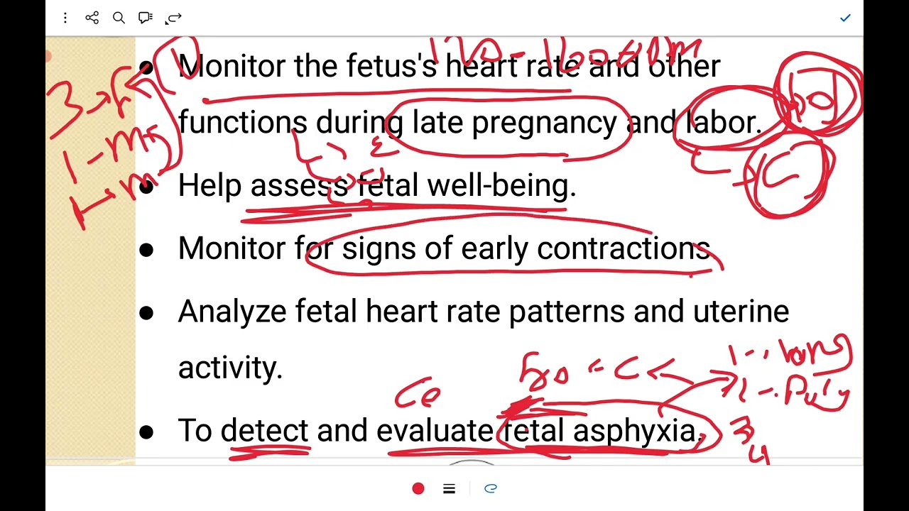 شرح بروسيجر  Electronic Fetal Heart  Rate 🙂🤗