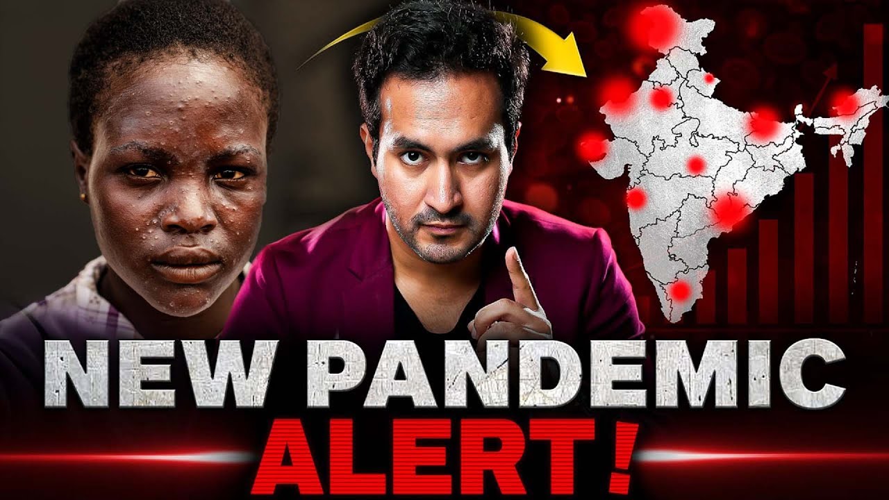 New PANDEMIC is Spreading Across The World | MPOX Virus Explained