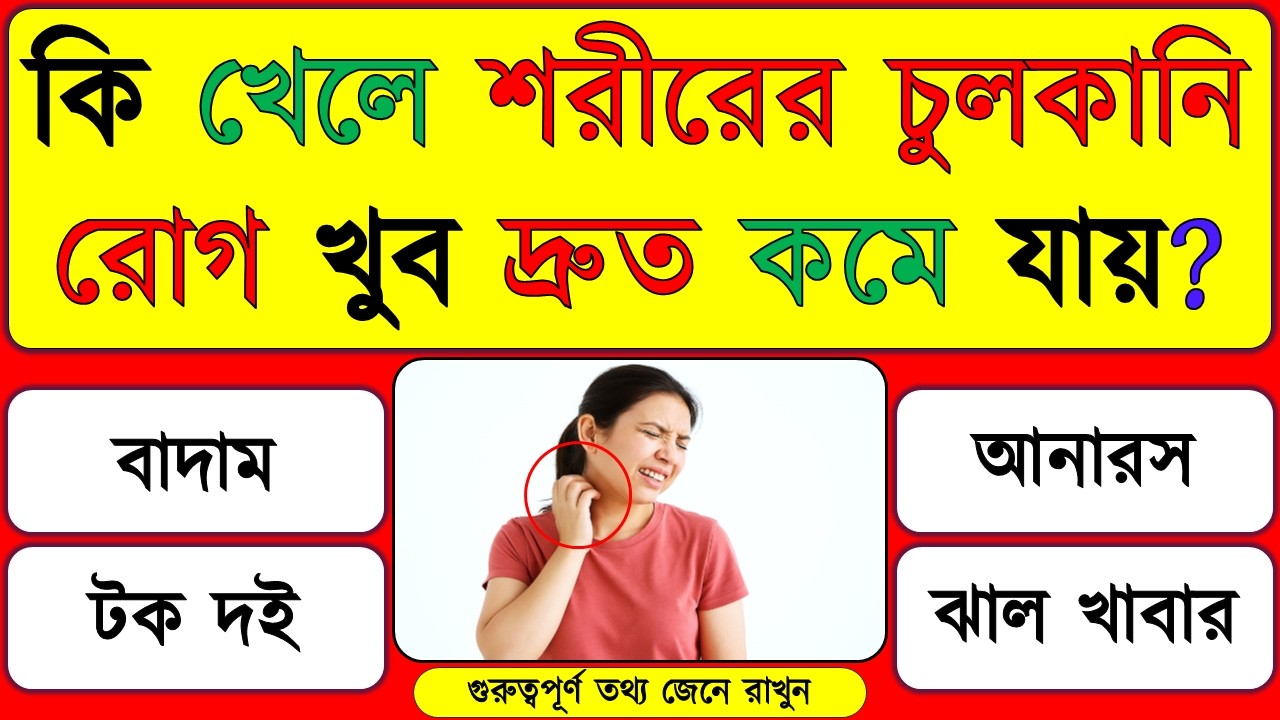 কি খেলে শরীরের চুলকানি রোগ খুব দ্রুত সেরে যায়| GK Quiz | Bangla Quiz | GK Question Answer | GK