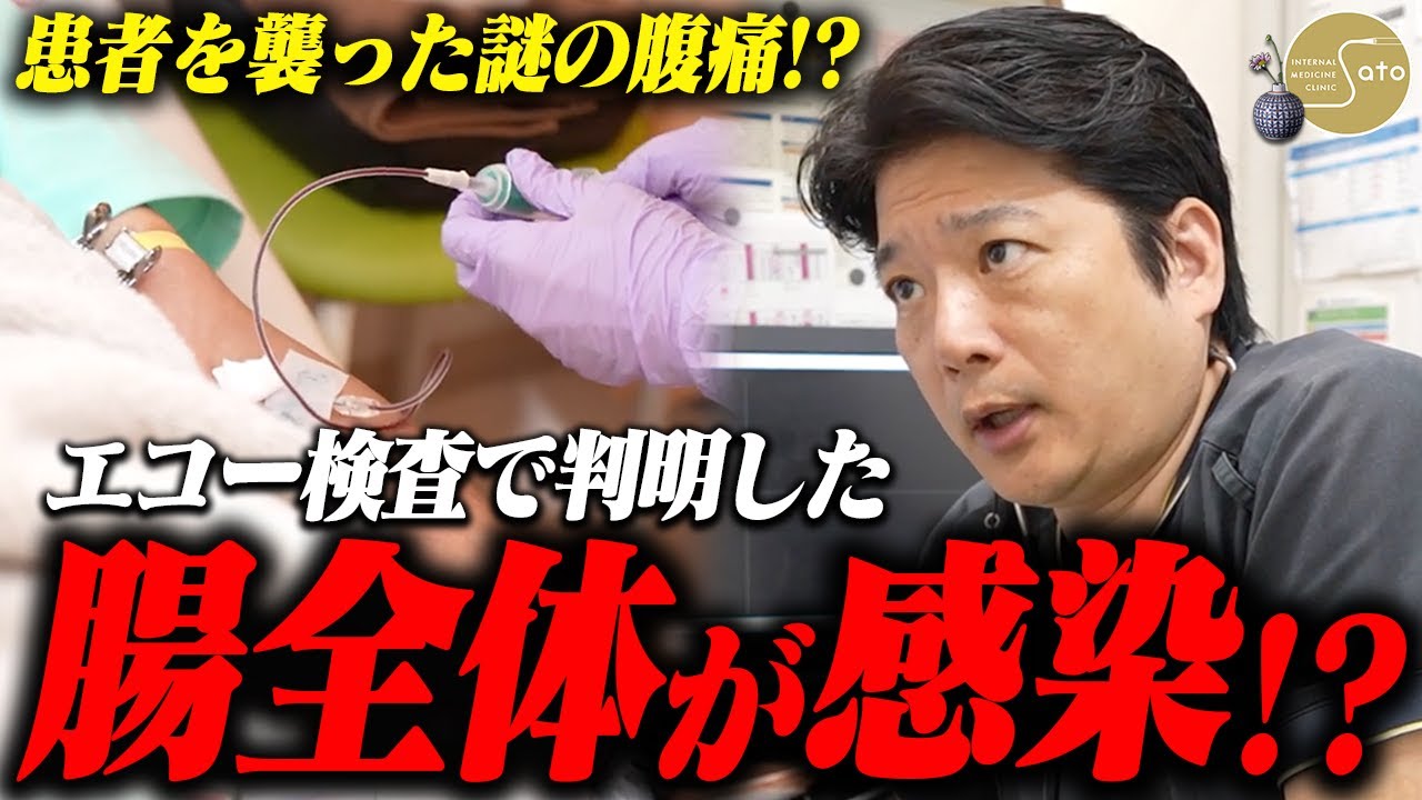 『すべての腸に蔓延！？』下痢・腹痛で眠れないと嘆く患者... 至急、検査を行い医師が診断！