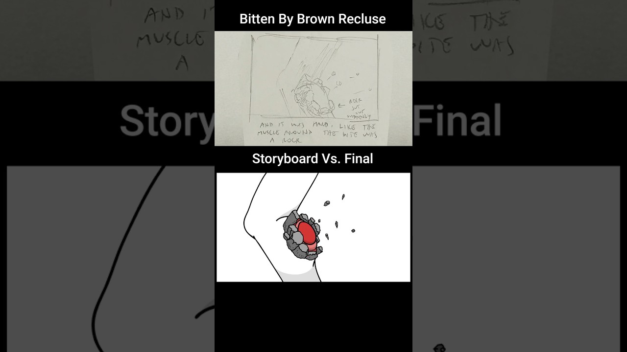 Storyboard vs Animation: Bitten by a Brown Recluse (scene 4) #storytimeanimation #storyboard
