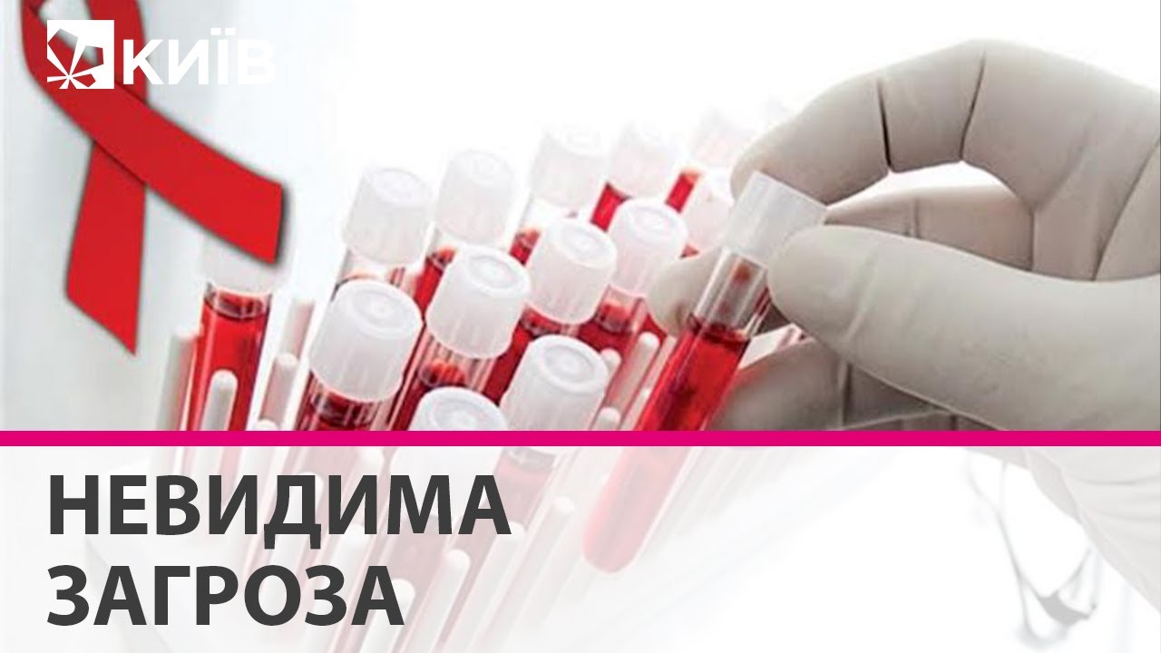 Через війну в Україні може побільшати хворих на ВІЛ-СНІД - експерт пояснив чому