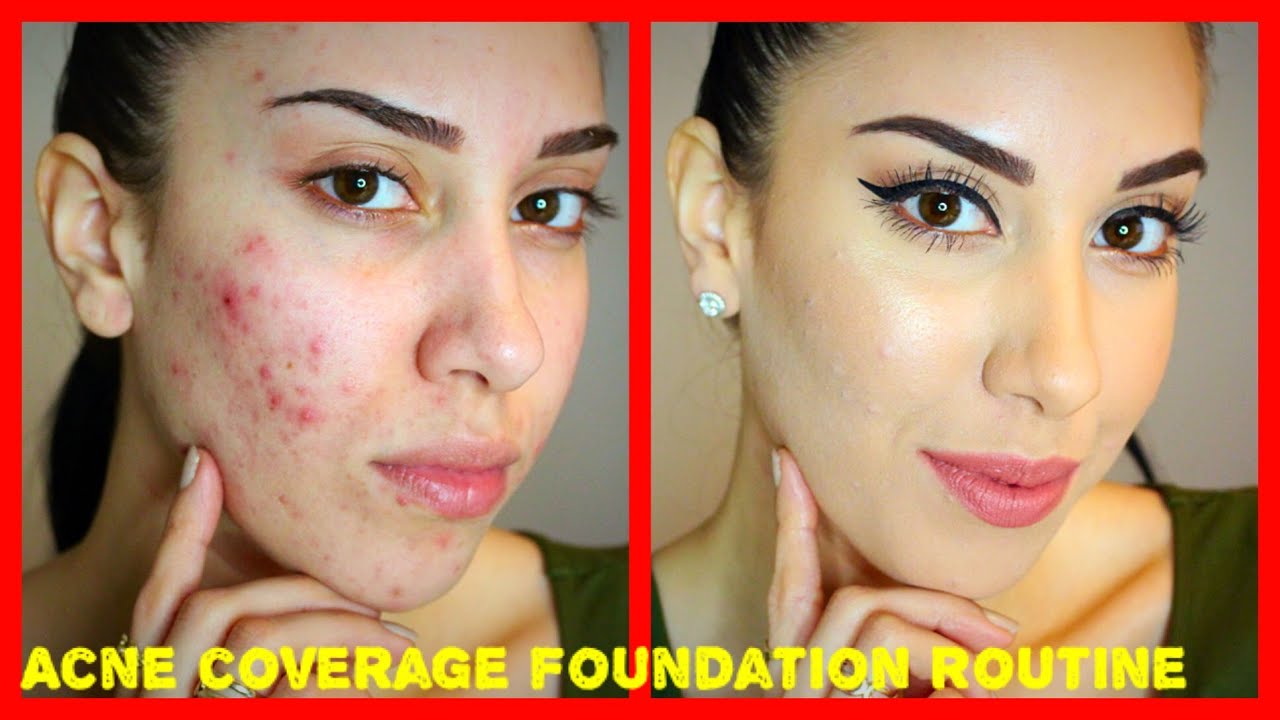 Acne Coverage Foundation Routine (PRE-ACCUTANE) Drugstore Products!!!
