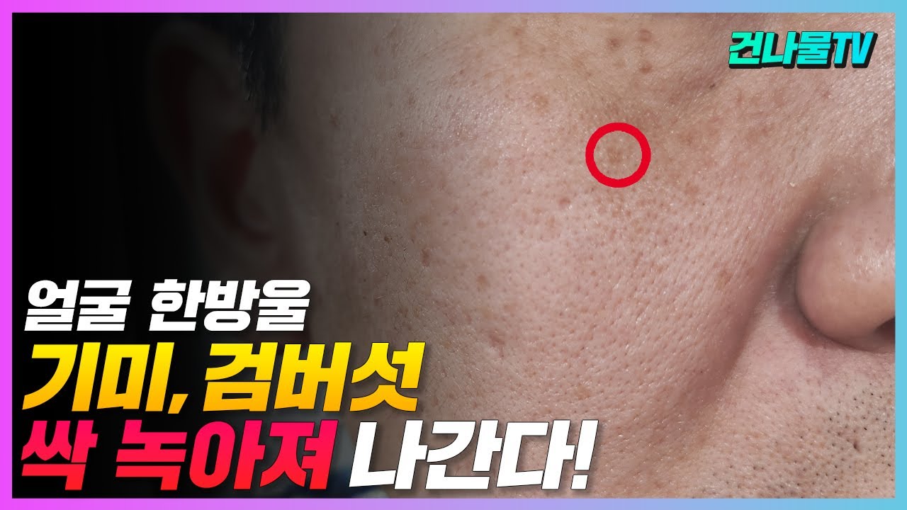 기미 검버섯 주근깨 한번에 쏙 떨어져 나간다!