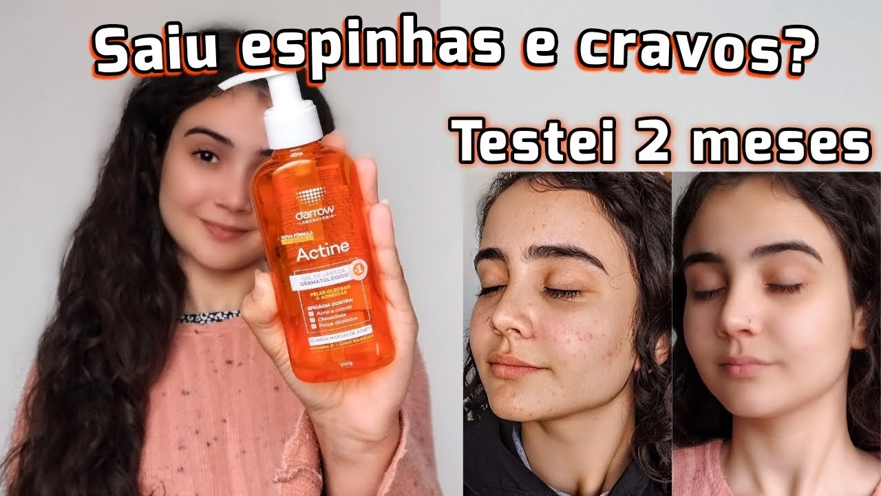 RESENHA SABONETE ACTINE DARROW • Mais indicado pelos dermatologistas • Vale apena?