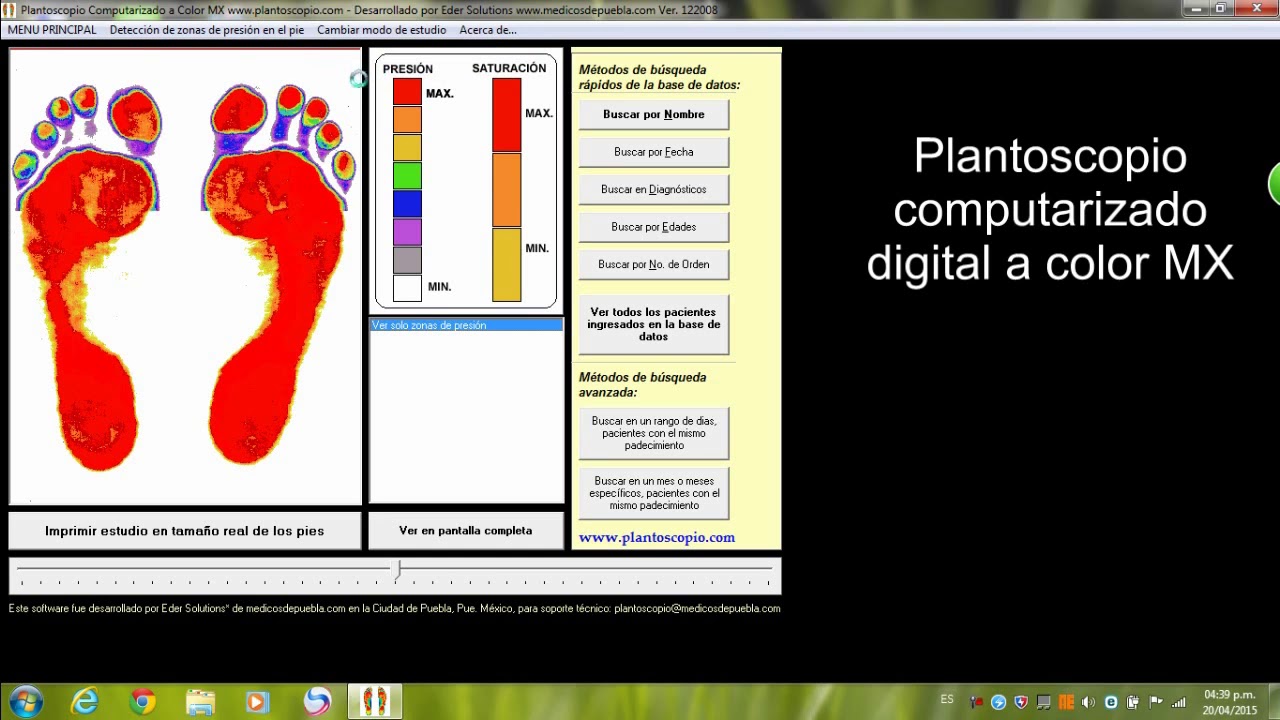 Plantoscopio computarizado a color MX