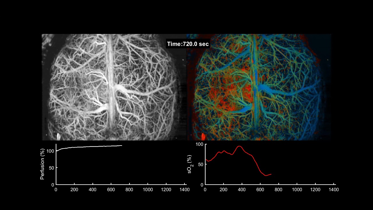 Photoacoustic Imaging Tracks Brain Hypoxia | Duke BME