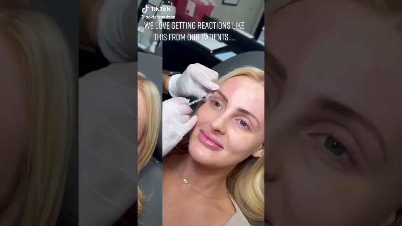 Look Lab - Undetectable Lip Filler