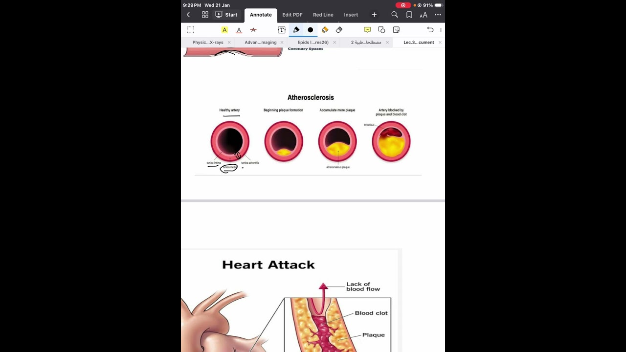 Medical terminology-cardiovascular system part3