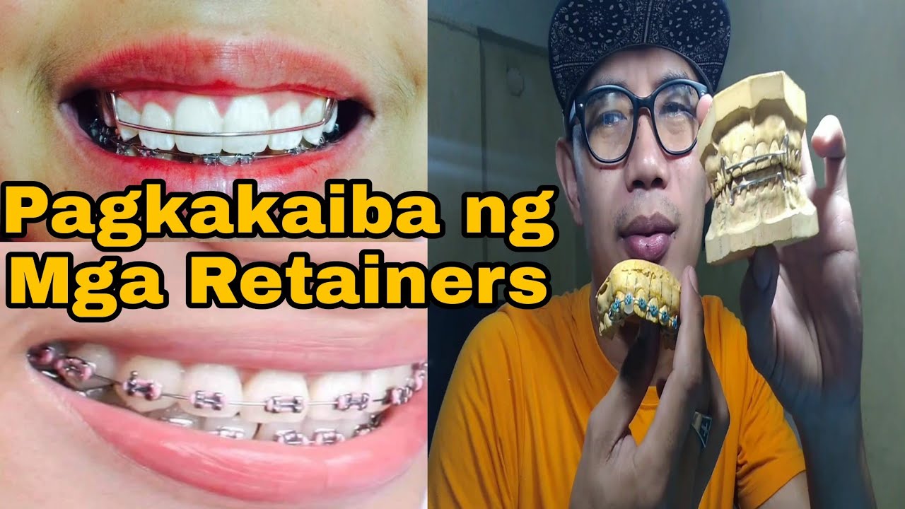 Different kinds of Retainers, Retainer like Braces with Gums, Pustiso/denture with Retainer designs.