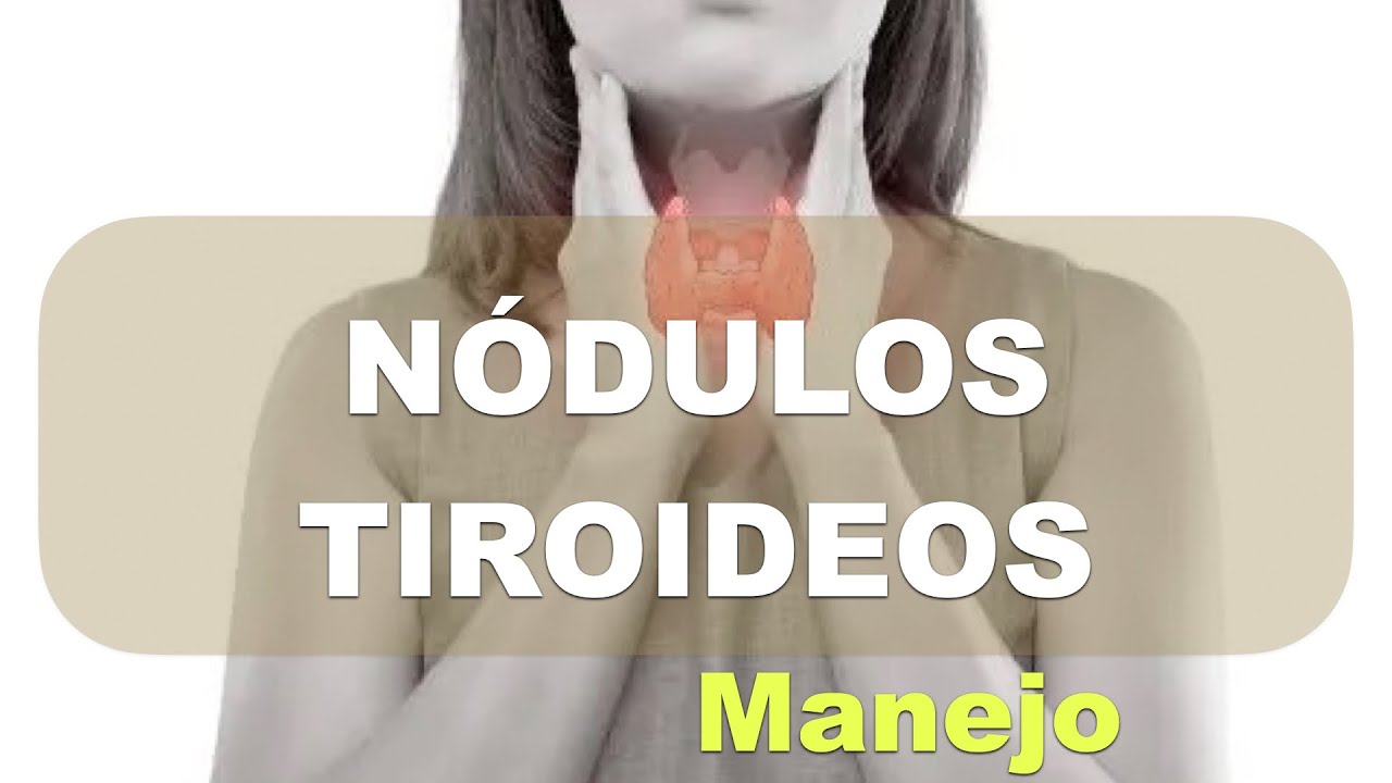 Nódulos Tiroideos: Manejo (parte 1): Clasificación de Bethesda