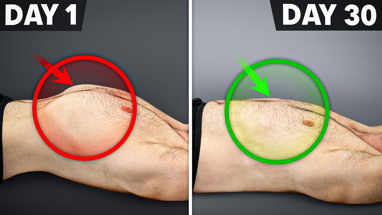 Fix Rib Flares & Other Problems in 30 Days