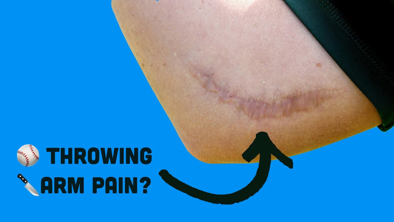 Arm Pain Do's and Don'ts for Baseball Players