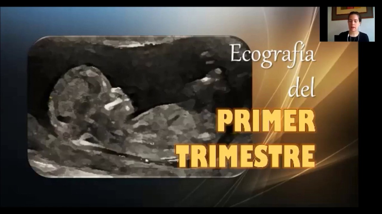 REPASO PRIMER TRIMESTRE