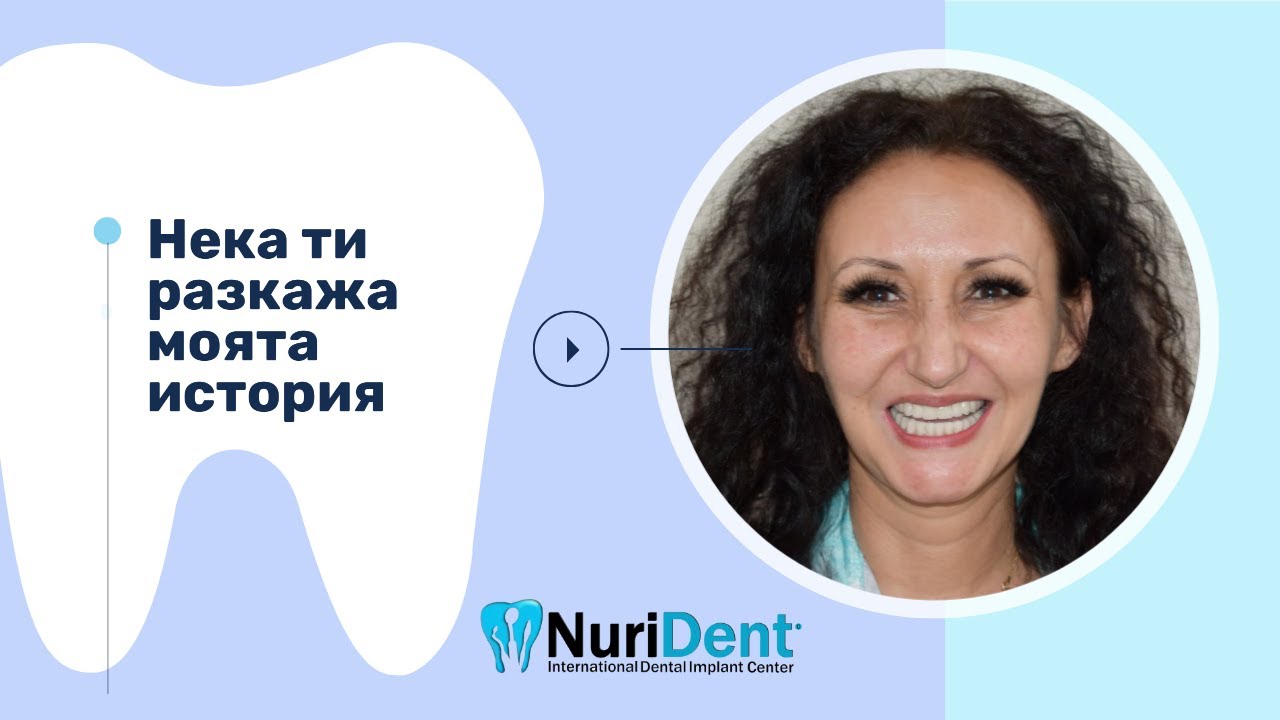 Болезнено ли e поставянето на базални импланти? Истината!