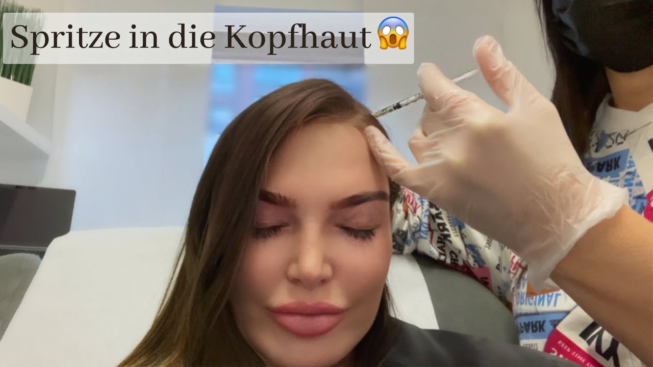 PRP Behandlung Haare - schnelleres & volleres Haarwachstum (auch bei Haarausfall)