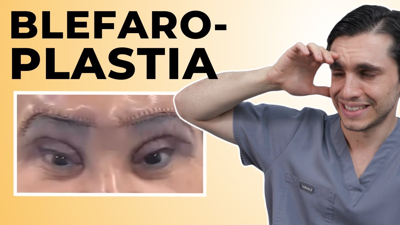 NO te hagas una Blefaroplastia sin saber esto | #3 ERRORES que te podrían llevar a MALOS resultados