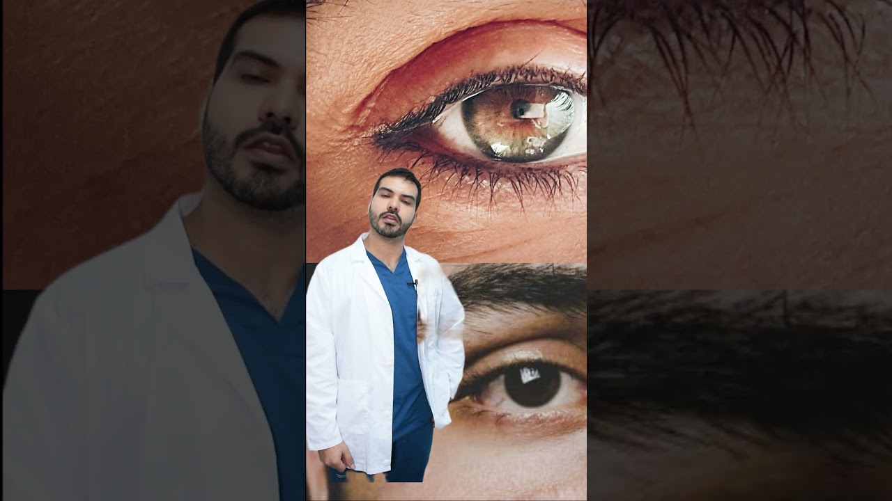 C&oacute;mo se ve un ojo con glaucoma