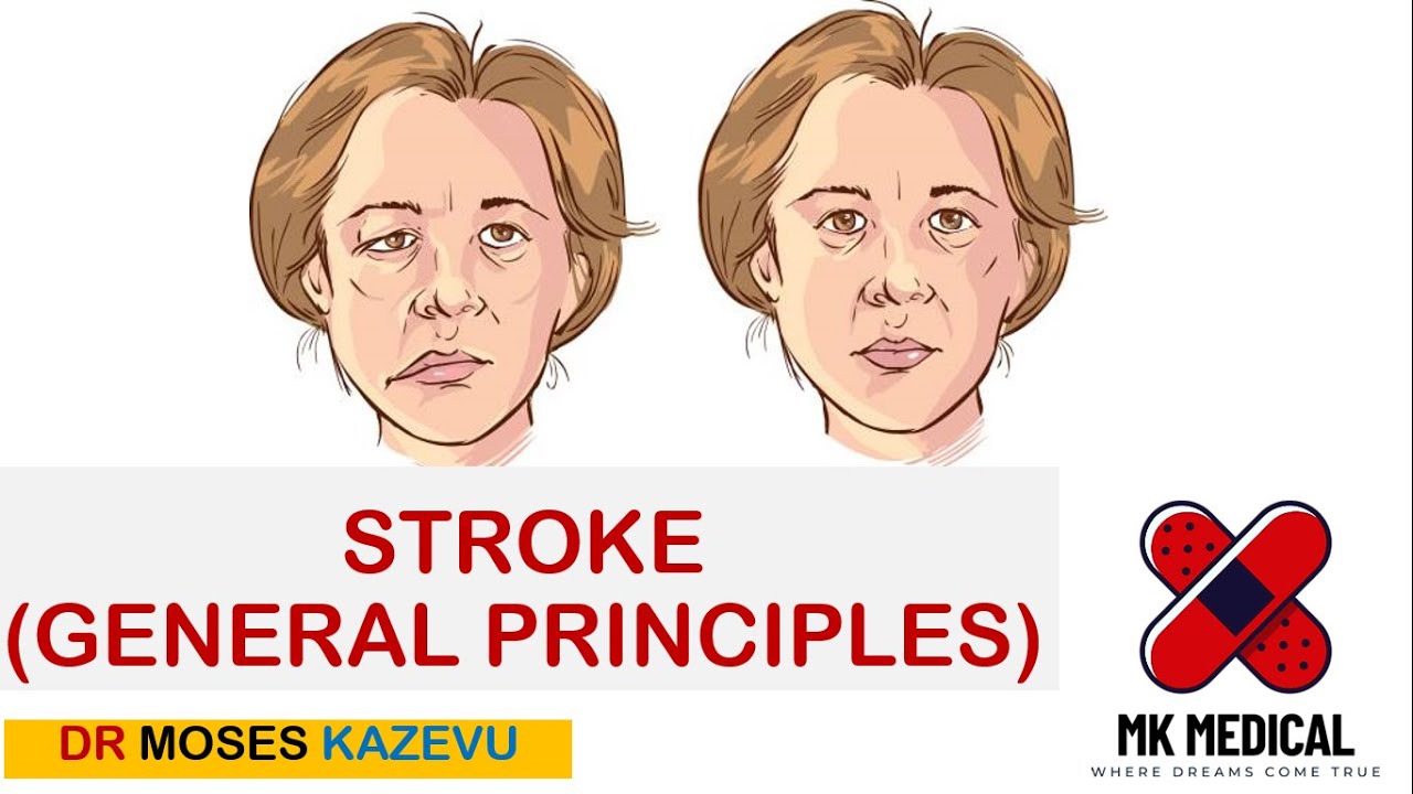 Stroke || General Principles || Part 1