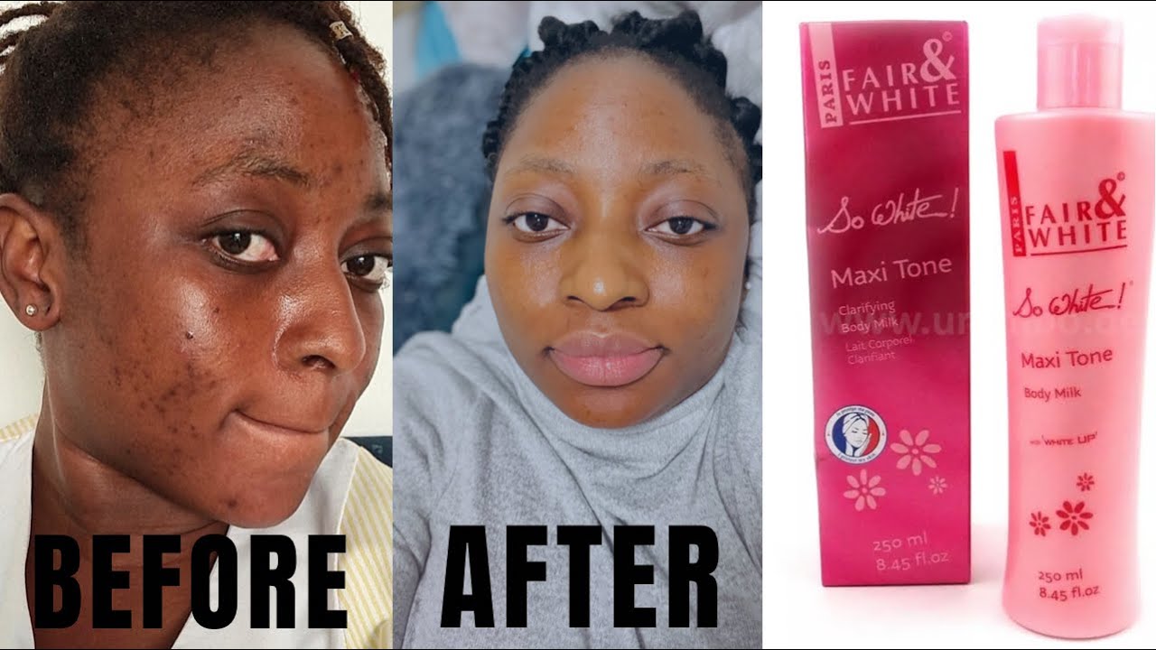 FAIR AND WHITE SO WHITE OIL FOR GLOWING SKIN MY HONEST REVIEW
