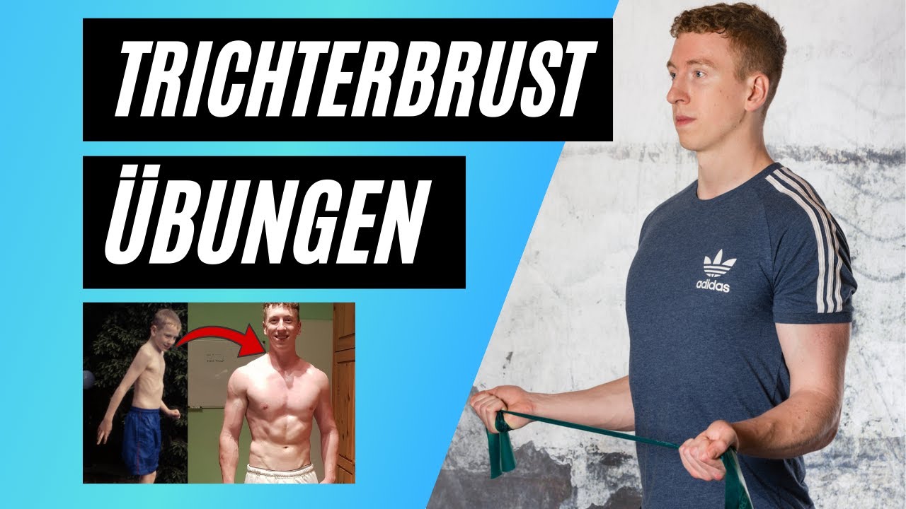 TOP 5 TRICHTERBRUST TRAINING ÜBUNGEN | Trichterbrust wegtrainieren