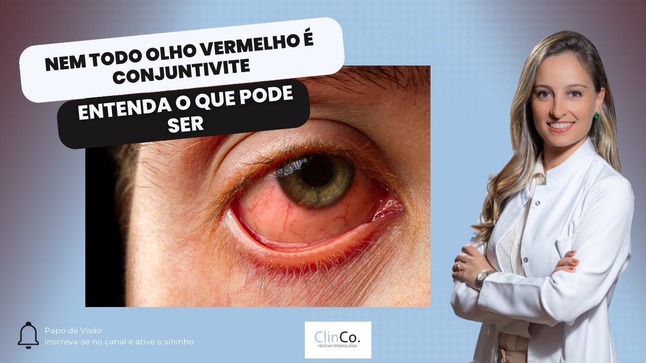 OLHO VERMELHO, QUANDO DEVO ME PREOCUPAR?