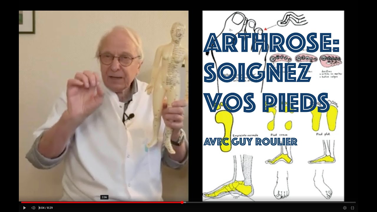 Vidéo L'arthrose peut commencer par les pieds par Guy Roulier