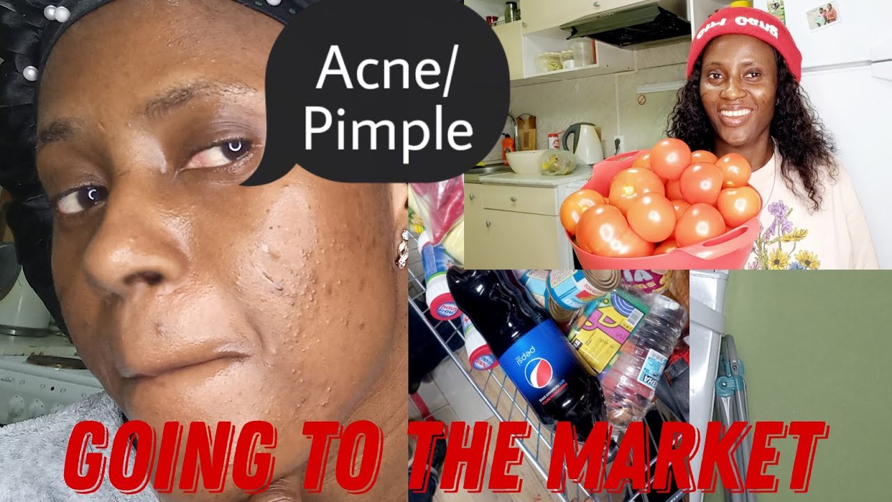 Busy morning🤦‍♀️I  went to the cheapest market in my city🙈,back pain problem 😭#busymorning#acne