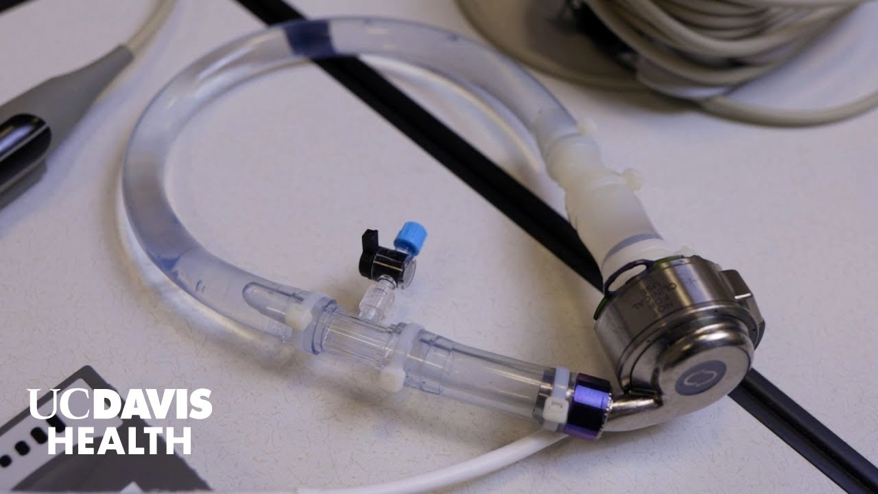 Объяснение LVAD — устройства поддержки левого желудочка при сердечной недостаточности | UC Davis ...