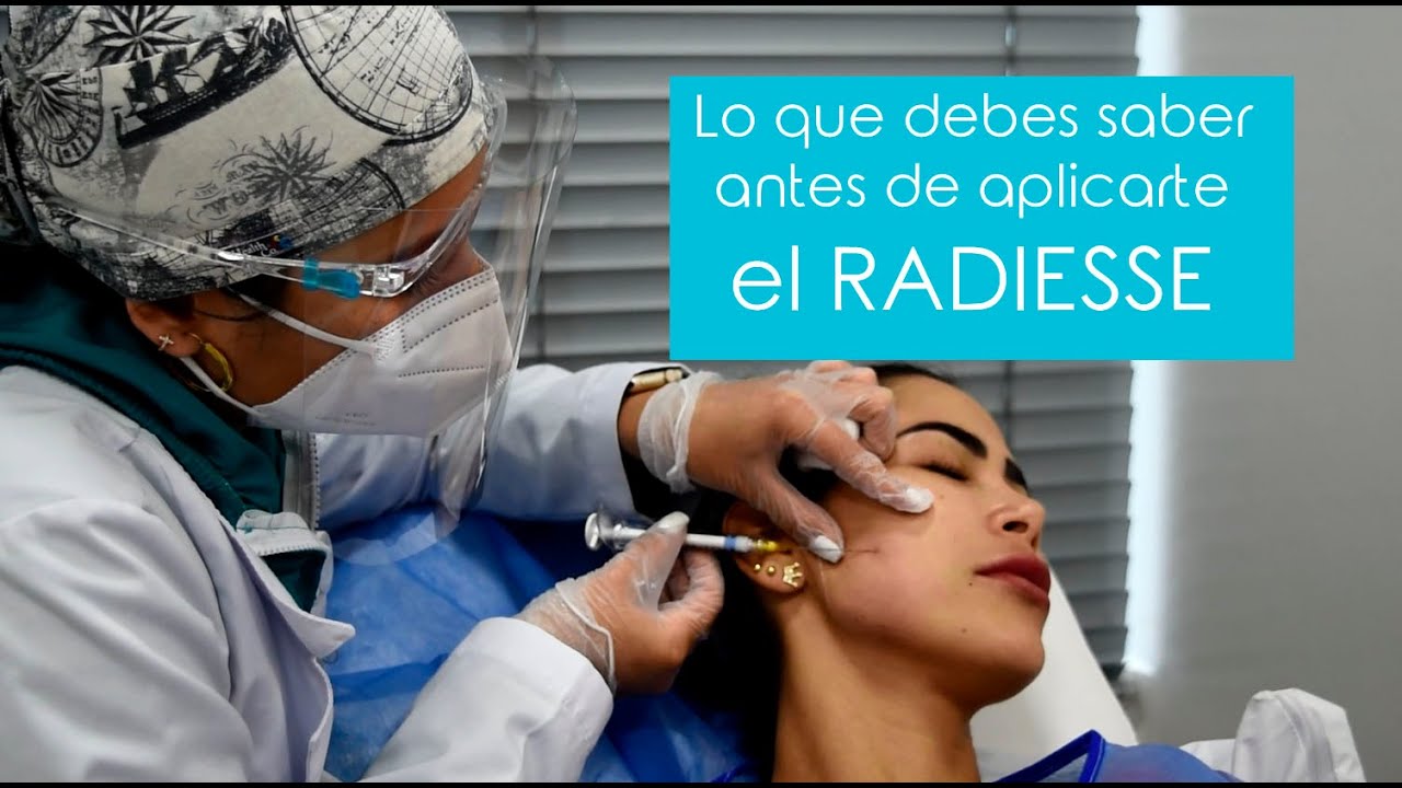 Preguntas y respuestas que debes escuchar antes de aplicarte el RADIESSE
