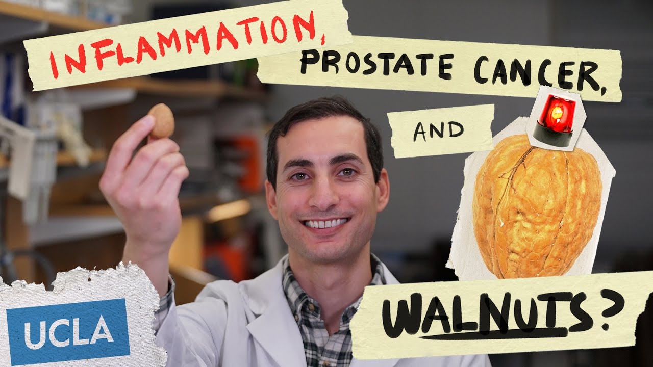 Inflammation, Prostate Cancer and.. Walnuts?